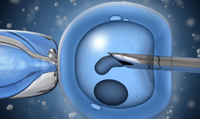 meddőség lombikbébi